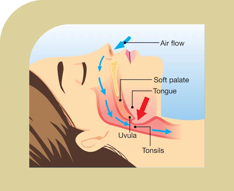 diagram showing open airway for breathing